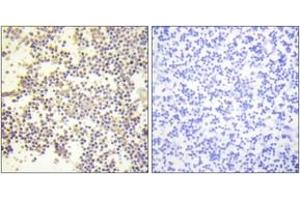 Immunohistochemistry analysis of paraffin-embedded human tonsil, using Neutrophil Cytosol Factor 1 (Phospho-Ser328) Antibody. (NCF1 antibody  (pSer328))