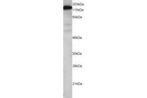 Image no. 1 for anti-Maternal Embryonic Leucine Zipper Kinase (MELK) (AA 639-651) antibody (ABIN290640) (MELK antibody  (AA 639-651))