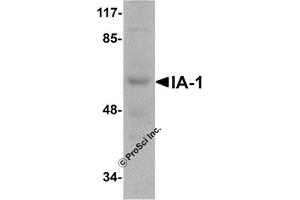 Western Blotting (WB) image for anti-Insulinoma-Associated 1 (INSM1) (N-Term) antibody (ABIN1031405) (INSM1 antibody  (N-Term))