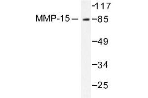 Image no. 1 for anti-Matrix Metallopeptidase 15 (Membrane-inserted) (MMP15) antibody (ABIN265526) (MMP15 antibody)