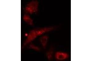 ABIN6277078 staining  Hela cells by IF/ICC. (LYN antibody  (C-Term))