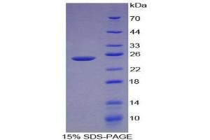 SDS-PAGE (SDS) image for Caldesmon 1 (CALD1) (AA 28-207) protein (His tag) (ABIN2124215)