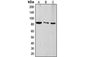 Western blot analysis of TLE4 expression in HeLa (A), Jurkat (B), HEK293T (C) whole cell lysates. (TLE4 antibody  (Center))