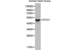 Western Blotting (WB) image for anti-8-Oxoguanine DNA Glycosylase (OGG1) (AA 1-345) antibody (ABIN3021937) (OGG1 antibody  (AA 1-345))