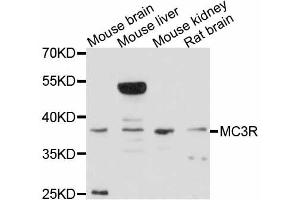 Western blot analysis of extracts of various cell lines, using MC3R antibody (ABIN4904319) at 1:3000 dilution. (MC3R antibody)