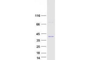 Upstream Transcription Factor 1 (USF1) (Transcript Variant 2) protein (Myc-DYKDDDDK Tag)