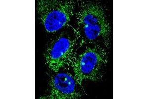 Confocal immunofluorescent analysis of ADH7 Antibody (C-Term) with NCI-H460 cell followed by Alexa Fluor® 488-conjugated goat anti-rabbit lgG (green). (ADH7 antibody  (C-Term))