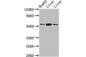 Western Blot Positive WB detected in: HepG2 whole cell lysate, Rat liver tissue, Mouse liver tissue All lanes: GPT antibody at 4. (ALT antibody  (AA 2-496))
