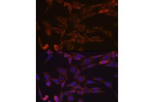 Immunofluorescence analysis of NIH-3T3 cells using Inhibin beta A (INHBA) (INHBA) Rabbit mAb (ABIN7267870) at dilution of 1:100 (40x lens). (INHBA antibody)