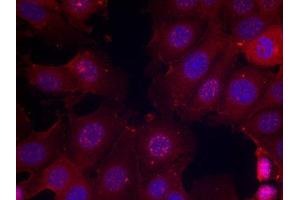 Immunofluorescence staining of methanol-fixed MCF cells using Phospho-ESR1-S167 antibody.