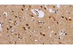 Immunohistochemistry of paraffin-embedded Human brain using IL19 Polyclonal Antibody at dilution of 1:40 (IL-19 antibody)