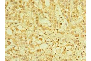 Immunohistochemistry of paraffin-embedded human adrenal gland tissue using ABIN7175978 at dilution of 1:100 (ZBTB32 antibody  (AA 1-294))