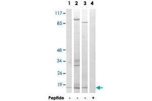 Western blot analysis of extracts from HeLa cells (Lane 1), COLO cells (Lane 2) and 293 cells (Lane 3 and lane 4), using MRPL14 polyclonal antibody . (MRPL14 antibody)