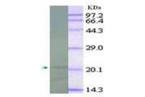 Image no. 2 for anti-Interleukin 18 (IL18) antibody (ABIN791564) (IL-18 antibody)