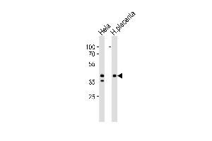 Western blot analysis of lysates from Hela cell line and human placenta tissue lysate (from left to right), using IDH3B Antibody at 1:1000 at each lane.