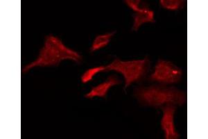 ABIN6274795 staining HeLa by IF/ICC. (CHRNB1 antibody  (N-Term))