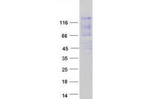 Validation with Western Blot (Ataxin 2-Like Protein (ATXN2L) (Transcript Variant C) (Myc-DYKDDDDK Tag))