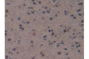 DAB staining on IHC-P; Samples: Mouse Brain Tissue (NPPC antibody  (AA 30-126))