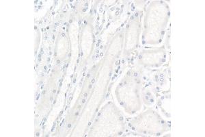 Immunohistochemistry of paraffin-embedded Human kidney (negative control sample) using CR2/CD21 Rabbit mAb (ABIN1678995, ABIN3015431, ABIN3015432 and ABIN7101406) at dilution of 1:200 (40x lens). (CD21 antibody)