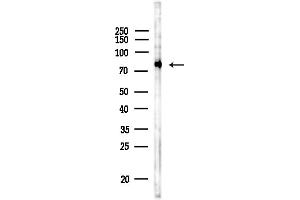 anti-TGF-beta Activated Kinase 1/MAP3K7 Binding Protein 3 (TAB3) (Internal Region) antibody