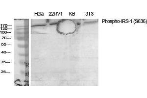 Western Blot (WB) analysis of specific cells using Phospho-IRS-1 (S636) Polyclonal Antibody. (IRS1 antibody  (pSer636))