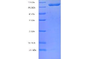 CCT2 Protein (AA 2-535) (His-SUMO Tag)