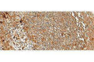 Immunohistochemistry of paraffin-embedded Human tonsil tissue using METTL17 Polyclonal Antibody at dilution of 1:60(x200) (METTL17 antibody)