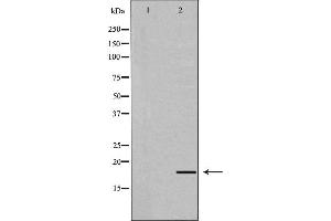Western blot analysis of extracts of Mouse liver,using UBD antibody. (UBD antibody  (Internal Region))