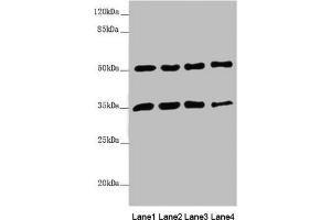 Western blot All lanes: MTX1 antibody at 3. (Metaxin 1 antibody  (AA 217-466))