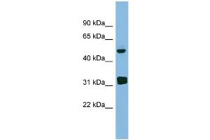 WB Suggested Anti-LYAR Antibody Titration: 0. (LYAR antibody  (Middle Region))