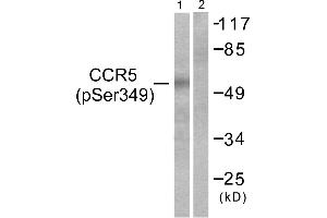 Western blot analysis of extracts from HeLa cells treated with PMA (125ng/ml, 30mins), using CCR5 (Phospho-Ser349) antibody. (CCR5 antibody  (pSer349))