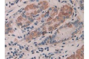 Immunohistochemistry (IHC) image for anti-Interleukin 35 (IL35) (AA 23-219) antibody (ABIN7438589)