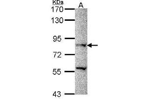 PRDM8 Antikörper  (N-Term)