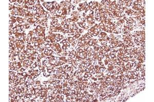 IHC-P Image Immunohistochemical analysis of paraffin-embedded HEP3B xenograft, using GRP94, antibody at 1:100 dilution. (GRP94 antibody  (C-Term))