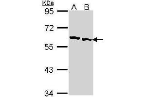 WB Image Sample (30 ug of whole cell lysate) A: Hep G2 , B: Raji 7. (CCT2 antibody)