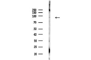 anti-Ribosomal Protein S6 Kinase, 90kDa, Polypeptide 5 (RPS6KA5) (pSer360) antibody