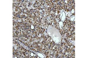 IHC analysis of AGPS using anti-AGPS antibody (ABIN7600146).