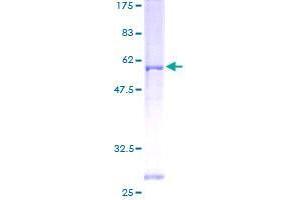 ZPBP Protein (AA 45-351) (GST tag)