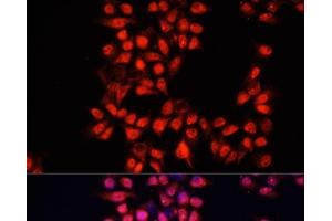 Immunofluorescence analysis of HeLa cells using ADAM10 Polyclonal Antibody at dilution of 1:100. (ADAM10 antibody)