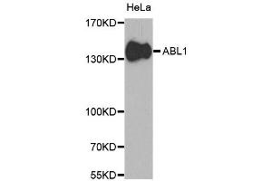 Western blot analysis of extracts of HeLa cells, using ABL1 antibody (ABIN5970109) at 1/1000 dilution. (ABL1 antibody  (C-Term))