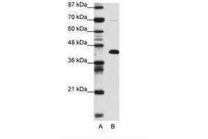 Image no. 1 for anti-Zinc Finger and BTB Domain Containing 25 (ZBTB25) (AA 181-230) antibody (ABIN6736153) (ZBTB25 antibody  (AA 181-230))