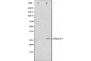 Western blot analysis on HeLa cell lysate using Galectin 3 Antibody,The lane on the left is treated with the antigen-specific peptide. (Galectin 3 antibody  (Internal Region))