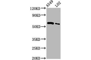 Western Blot Positive WB detected in: A549 whole cell lysate, LO2 whole cell lysate All lanes: PARP3 antibody at 3. (PARP3 antibody  (AA 1-240))