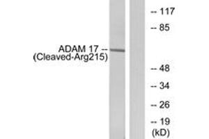 Western blot analysis of extracts from rat liver cells, using ADAM 17 (Cleaved-Arg215) Antibody.
