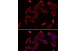 Immunofluorescence analysis of MCF7 cells using PDHX Polyclonal Antibody (PDHX antibody)