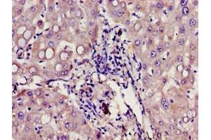 Immunohistochemistry of paraffin-embedded human liver tissue using ABIN7154509 at dilution of 1:100 (Growth Hormone Receptor antibody  (AA 19-184))