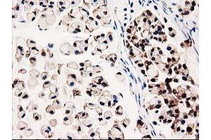 Image no. 5 for anti-UDP-Galactose-4-Epimerase (GALE) antibody (ABIN1498366)