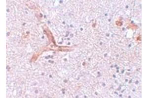 Immunohistochemical staining of human brain tissue with ZC3H12C polyclonal antibody  at 5 ug/mL dilution. (ZC3H12C antibody  (N-Term))