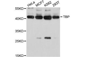 Western blot analysis of extracts of various cell lines, using TBP antibody (ABIN5971218) at 1/1000 dilution. (TBP antibody)