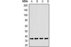 Western Blotting (WB) image for anti-C-Type Lectin Domain Family 12, Member A (CLEC12A) antibody (ABIN7307666)